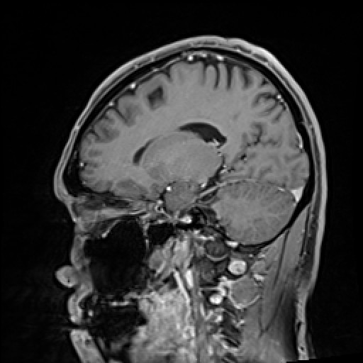 Click on the Serie image to view the images of VILLANUEVA, WILLIAM A.